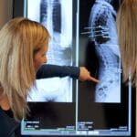 Chiropractor showing x-ray images
